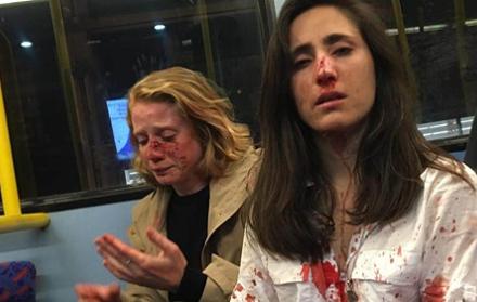 Las dos mujeres, que han sido dadas de alta en el hospital, fueron atacadas cuando los varones se percataron de que eran pareja.