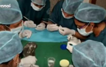 El niño fue operado en el Saveetha Dental College, en India.
