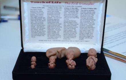 El lobby antiaborto presentó una maqueta de fantasía en la que el embrión de una semana de gestación aparece con todos sus rasgos definidos.