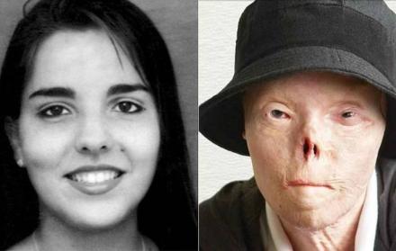 El pasado sábado 20 de abril, Saburido falleció a causa de un cáncer.