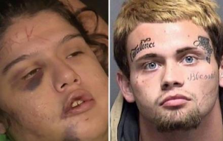 El agresor durante una hora golpeó a la joven, cuando se cansó decidió escribir con un cuchillo en su frente.