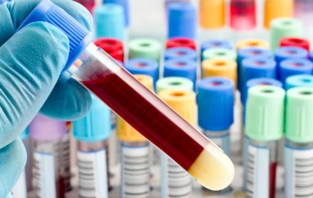 La investigación explica que el novedoso test permite evaluar los niveles de la proteína beta amiloide, ligada al Alzheimer.