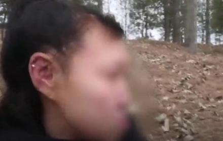 Una niña de nacionalidad china sufre progeria.
