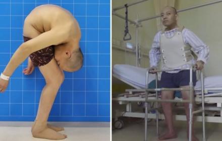 Li Hua después de 28 años pudo lenvantar su cabeza y erguir su cuerpo.