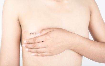 Tatuadora inglesa ayuda a mujeres con mastectomía a recuperar su feminidad. 