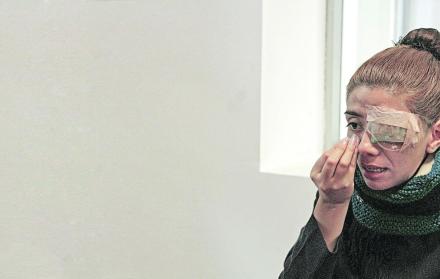 La cirugía para reconstruirle el globo ocular duró poco más de ocho horas. Sin embargo, la joven no volverá a ver con su ojito izquierdo.