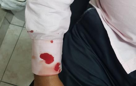 El hecho se produjo en los exteriores de su consultorio, en Los Esteros.