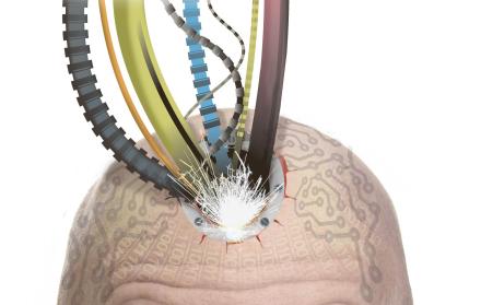 La idea (de negocio) es crear chips que doten al cerebro de nuevas habilidades