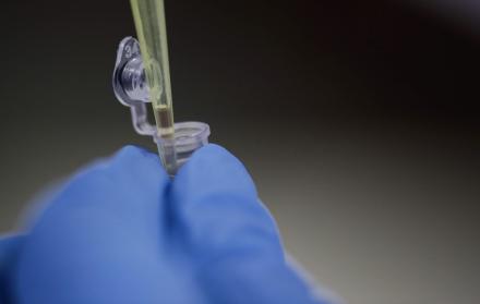 Detalle de frascos con muestras de laboratorio el 25 de enero de 2021, en San José (Costa Rica).