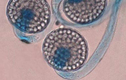 Imagen tomada a través de un microscopio que muestra un hongo Circinella lampensis.