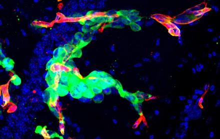 Imagen de la metástasis en cerebro de ratón cedida por el CNIO. En verde, células tumorales que permanecen ‘escondidas’ después de una cirugía y que actúan como potenciales semillas para la reaparición de la metástasis.