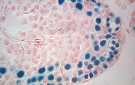 Sección transversal de un testículo de ratón infértil que muestra células germinales y espermatozoides de rata previamente congelados.