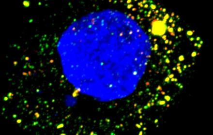 Imagen cedida de microscopía de fluorescencia de una célula hepática humana cultivada infectada por el virus de la hepatitis A.