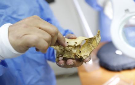 Los estudiantes de medicina de la Universidad de Guayaquil trabajan con cuerpos reales durante las prácticas de Anatomía.