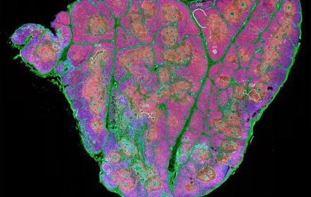Sección de tejido completo de un timo humano después del nacimiento, que muestra timocitos (rojo), células epiteliales (cian) y células madre junto a zonas de fibronectina (verde).