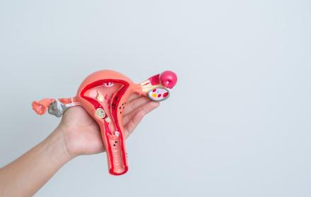 El endometrio es un tejido que puede causar muchas molestias