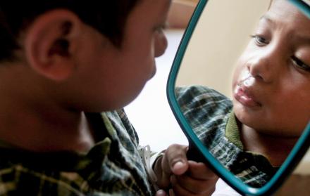 Fundación con fisura labiopalatina