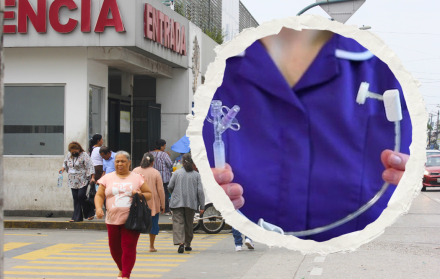 técnica gastrostomía percutánea endoscópica Hospital Teodoro Maldonado Carbo may 25 CV