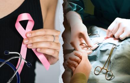 Cirugías cáncer de mama