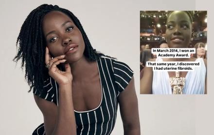 Lupita Nyong'o habla sobre su fibrosis uterina