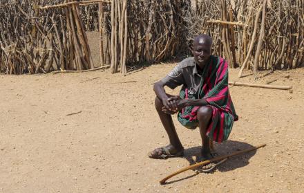 Paciente de micetoma