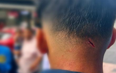 herida metropolitano guayaquil