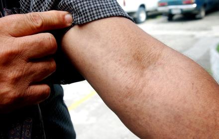 piel municipio de guayaquil