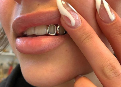 Peligro en TikTok: Dentistas en Ecuador alertan sobre moda de los 'grillz' removibles