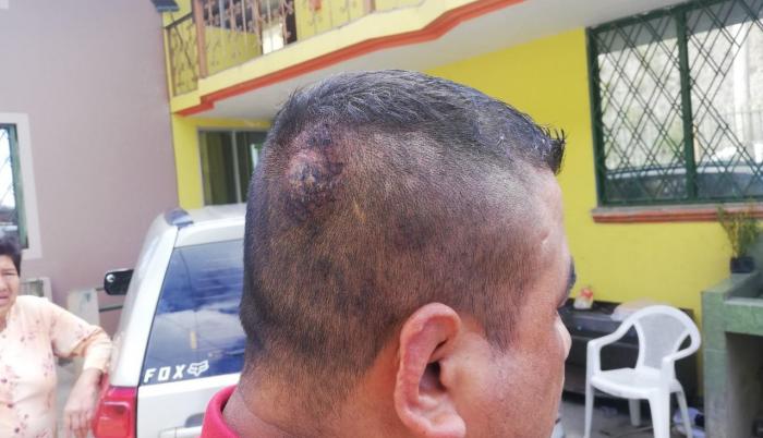 pelea kaviedes cuenca