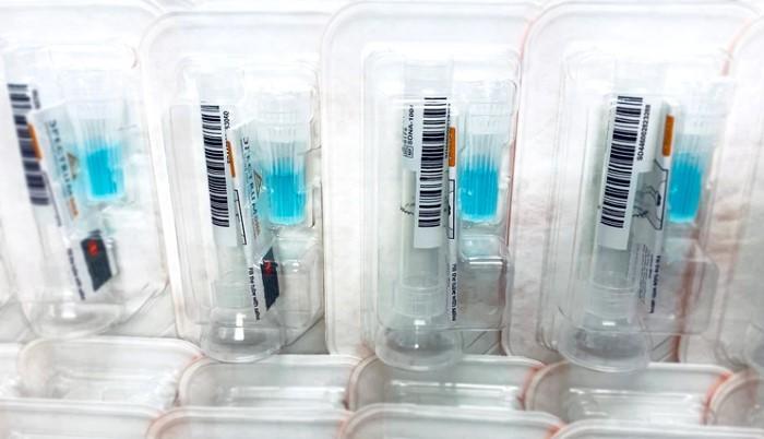 Con esta sencilla prueba se agilizará el diagnostico de coronavirus.