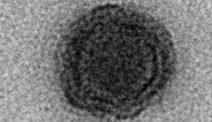 yaravirus-ktwG-U100109796309wiC-624x385@Ideal
