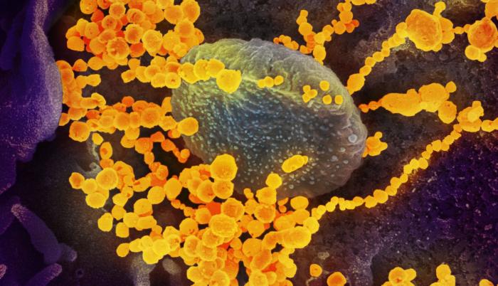 imagen de microscopio electrónico que muestra (objetos en amarillo) al SARS-CoV-2, el virus que causa el brote del coronavirus COVID-19