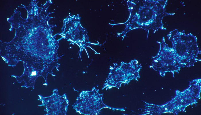células cancerígenas