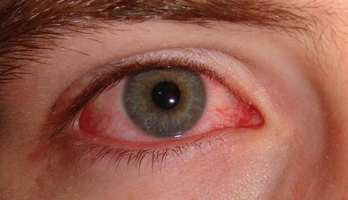 800px-Pink_eye