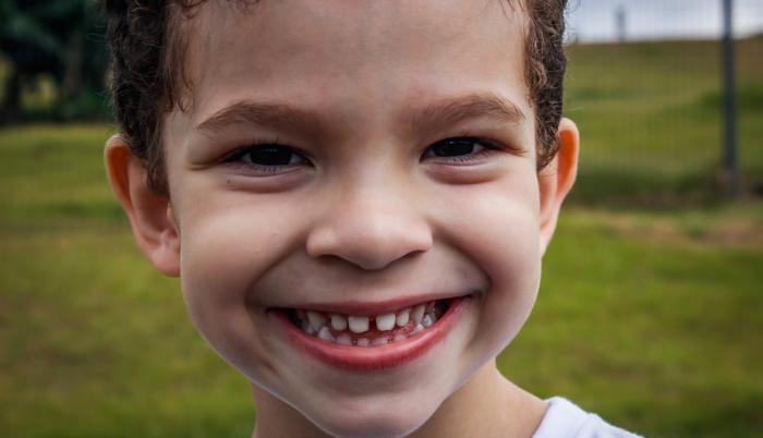 dientes