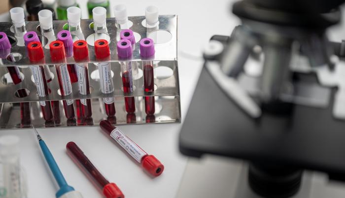 Vacunas contra el coronavirus. Imagen de stock de Pixabay. 21 de mayo de 2020.
