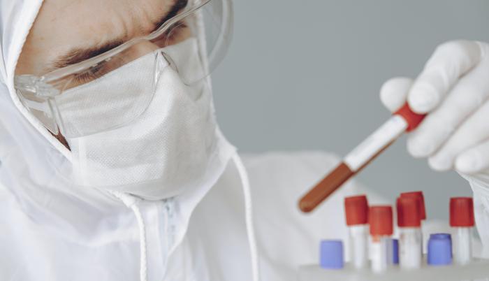 Coronavirus. Pexels. 5 de junio de 2020.