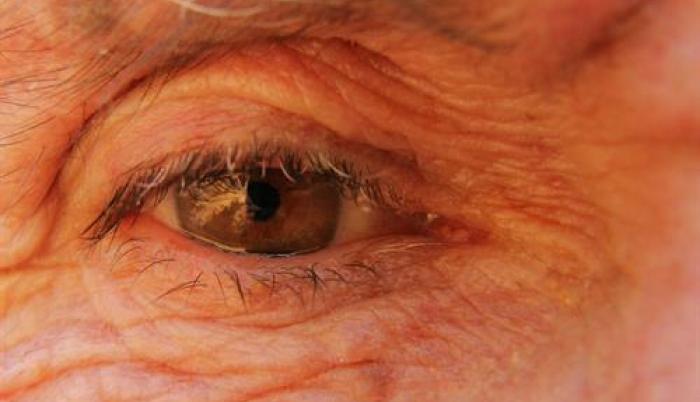 OJO REFERENCIAL