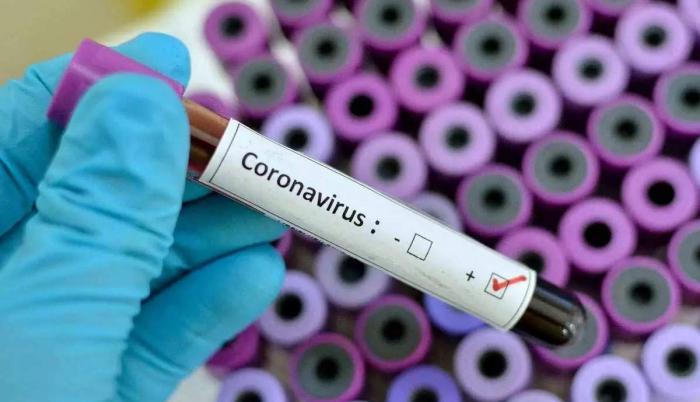 Prueba-Covid-Cifras
