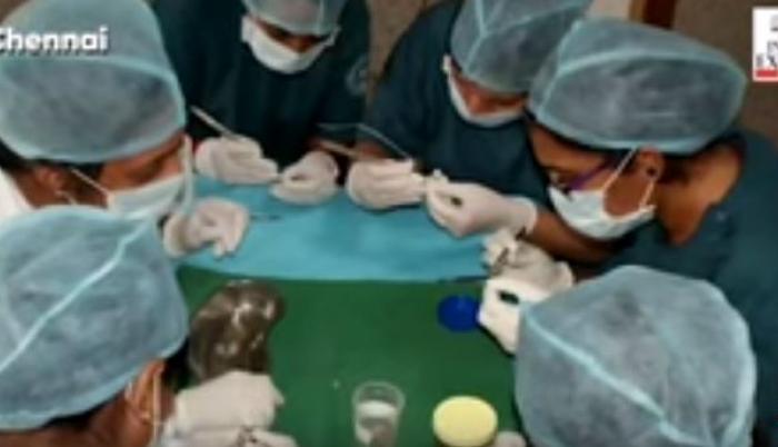 El niño fue operado en el Saveetha Dental College, en India.