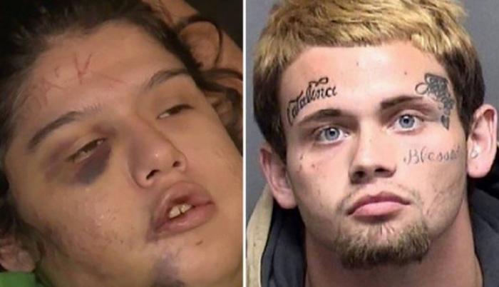 El agresor durante una hora golpeó a la joven, cuando se cansó decidió escribir con un cuchillo en su frente.
