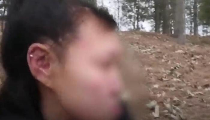 Una niña de nacionalidad china sufre progeria.