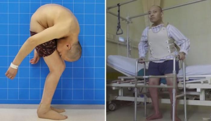Li Hua después de 28 años pudo lenvantar su cabeza y erguir su cuerpo.