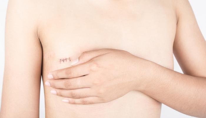 Tatuadora inglesa ayuda a mujeres con mastectomía a recuperar su feminidad.