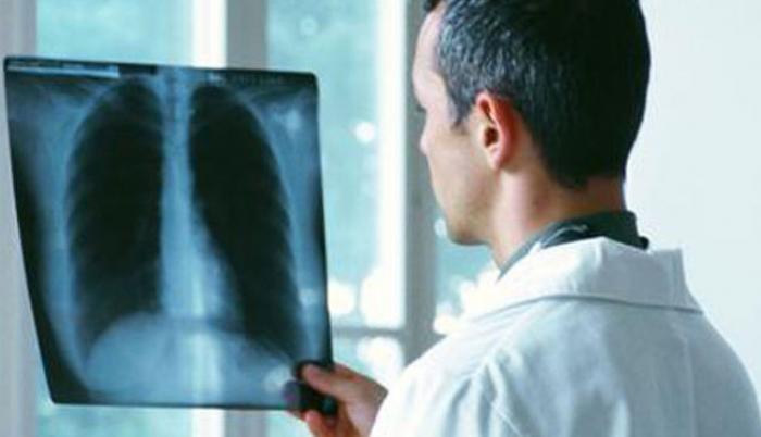 Pulmones
