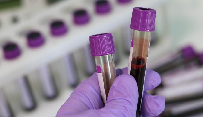 sangre-examen-laboratorio