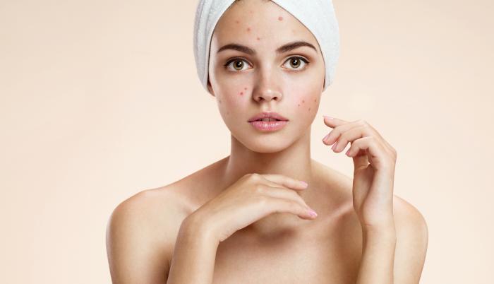 Tratamiento de láser recomendado para eliminar manchas.
