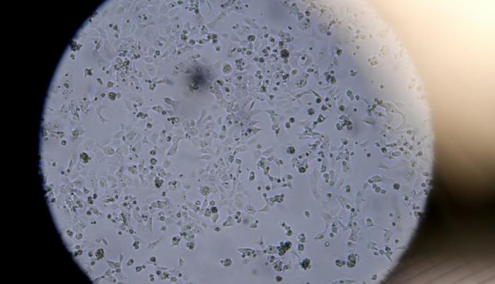 vacuna coronavirus