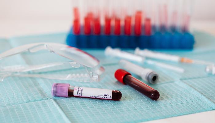 Pexels. Coronavirus. Muestras de sangre...