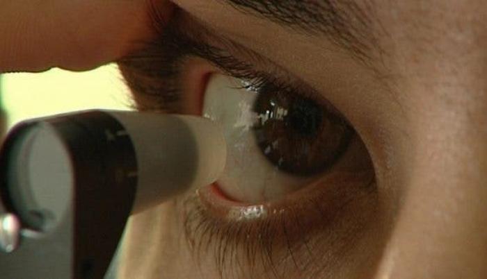 degeneracion-macular